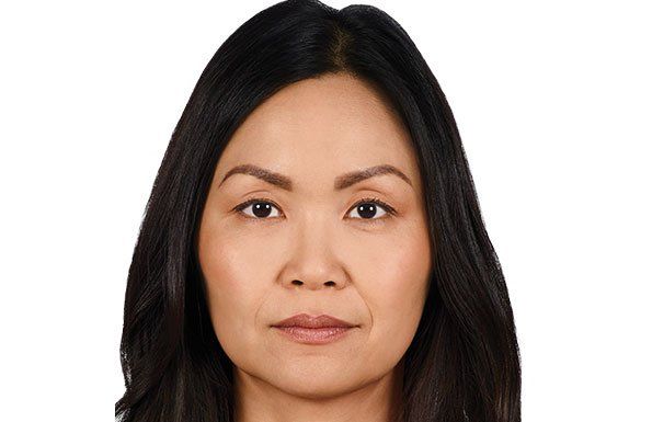 Allergan Fillers before photo