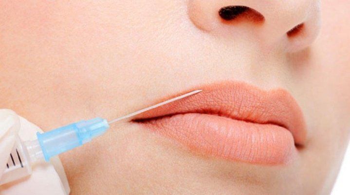 Filler botox