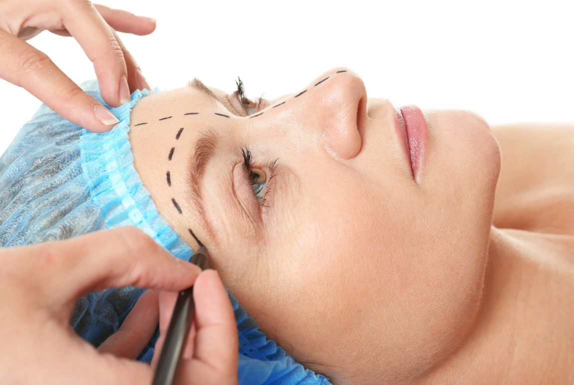 rimodellamento viso