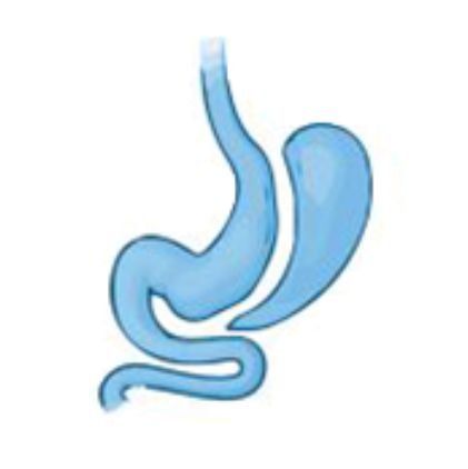 वज़न घटाने की शल्य - क्रिया | Sleeve Gastrectomy वज़न घटाने की शल्य - क्रिया | Sleeve Gastrectomy