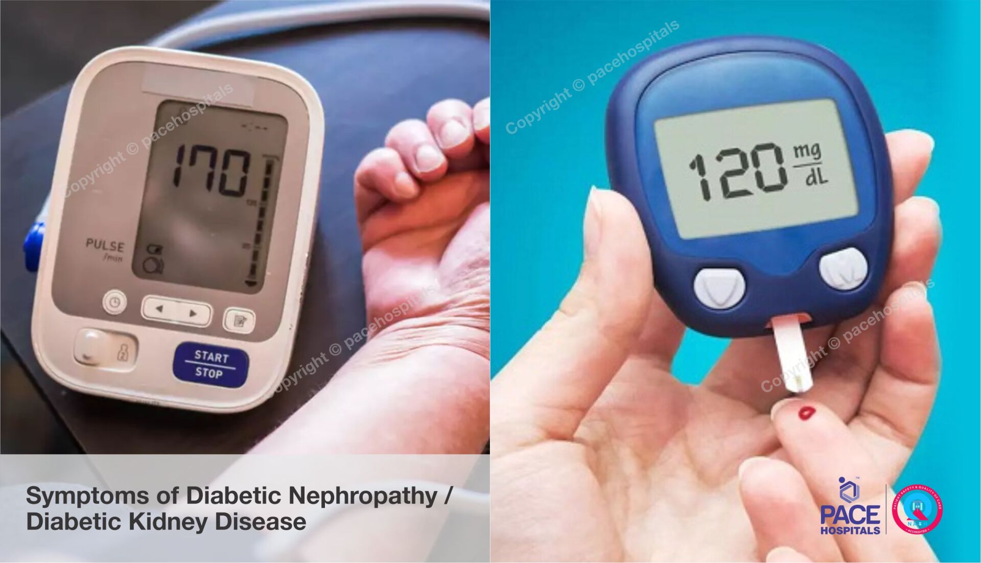 signs and symptoms of Diabetic Nephropathy, Diabetic Kidney Disease signs and symptoms of Diabetic Nephropathy, Diabetic Kidney Disease