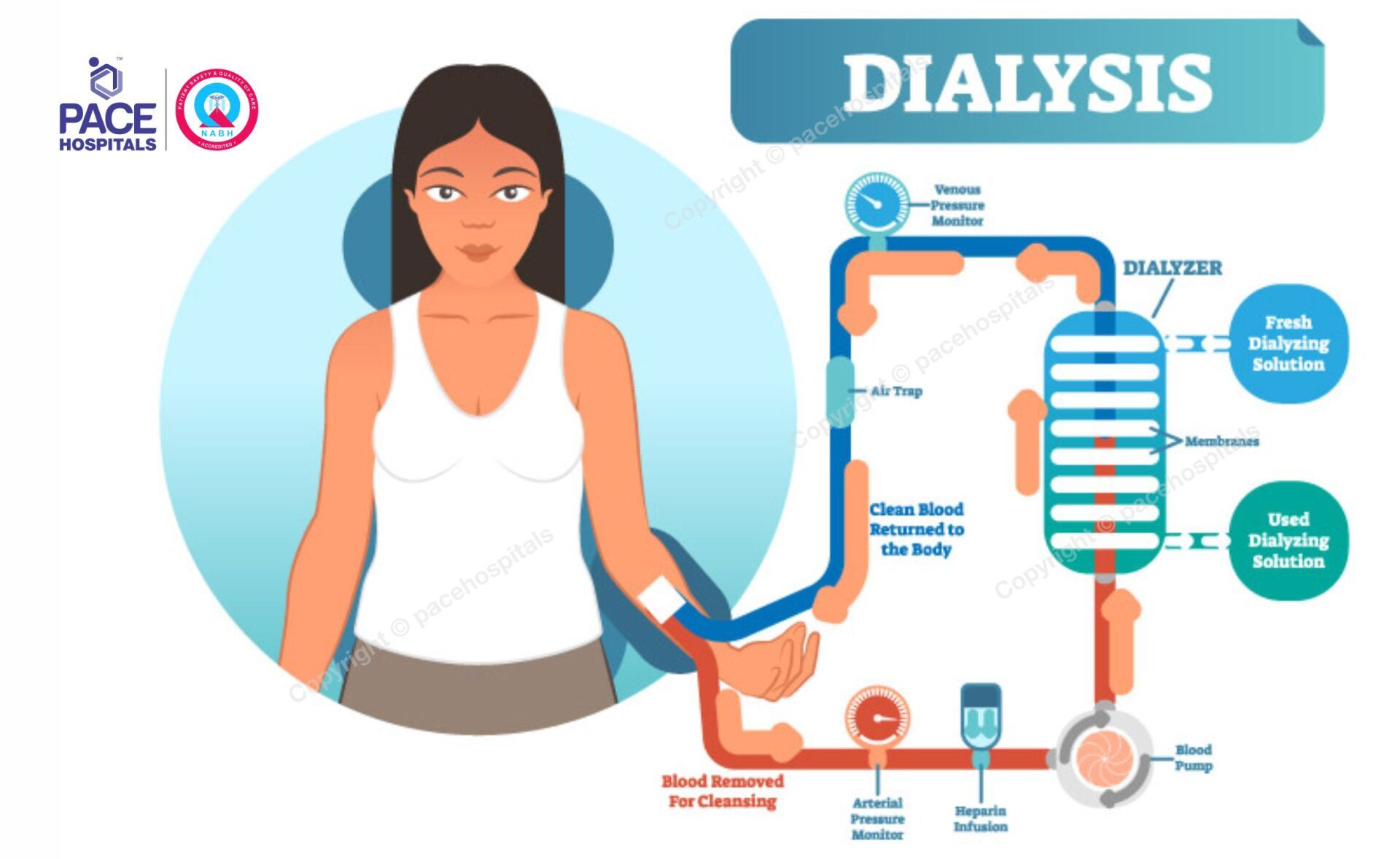 Treatment for advanced diabetic nephropathy Treatment for advanced diabetic nephropathy