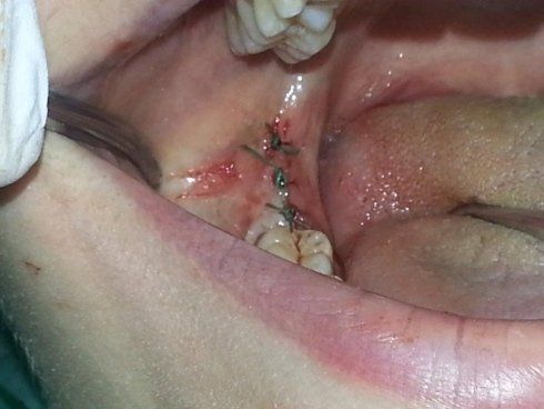 Chirurgia dentale