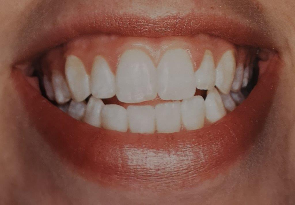 Primo piano di una bocca sorridente con denti bianchi e brillanti e labbra dai toni rossi.