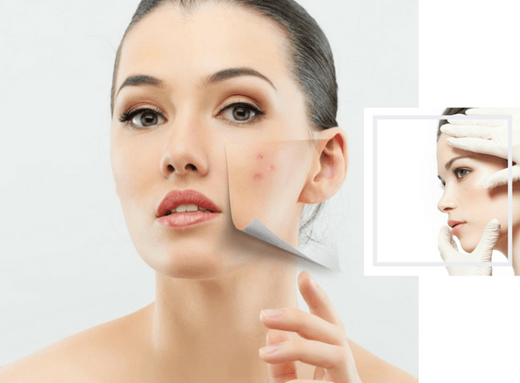 Woman remove her old dry skin from face