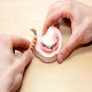 Dental Bridges— Family Dentistry in Castleton, NY Dental Bridges— Family Dentistry in Castleton, NY