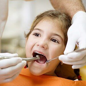 Dental Fillings — Family Dentistry in Castleton, NY Dental Fillings — Family Dentistry in Castleton, NY