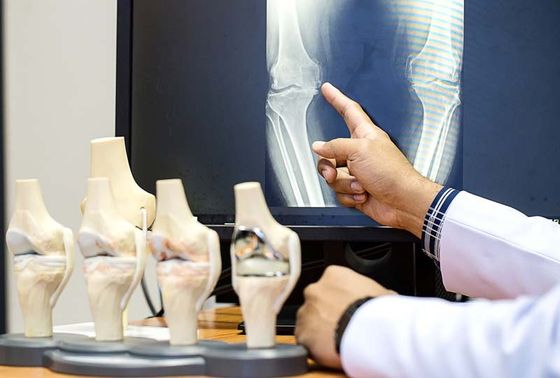 Sports Medicine — X-ray of Bone in Lake Success, NY Sports Medicine — X-ray of Bone in Lake Success, NY