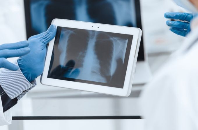 radiografia