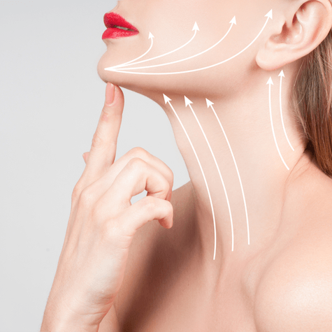 tratti su viso e collo di una donna per intervento di lifting facciale