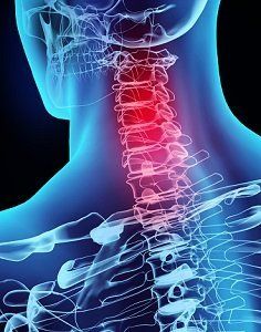 X-ray of human neck — Chiropractic Treatment in Phoenix, AZ X-ray of human neck — Chiropractic Treatment in Phoenix, AZ