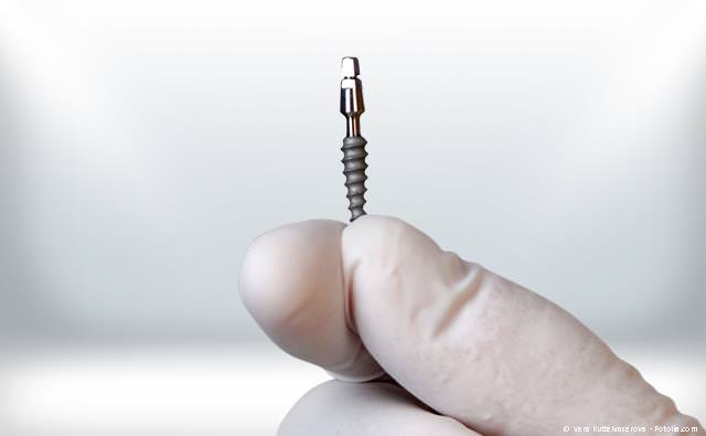 Implantation ohne Skalpell und Nadel: Schonender und schneller als herkömmliche Implantationsverfahren Implantation ohne Skalpell und Nadel: Schonender und schneller als herkömmliche Implantationsverfahren