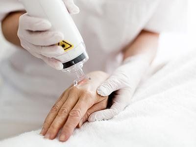 Trattamento laser