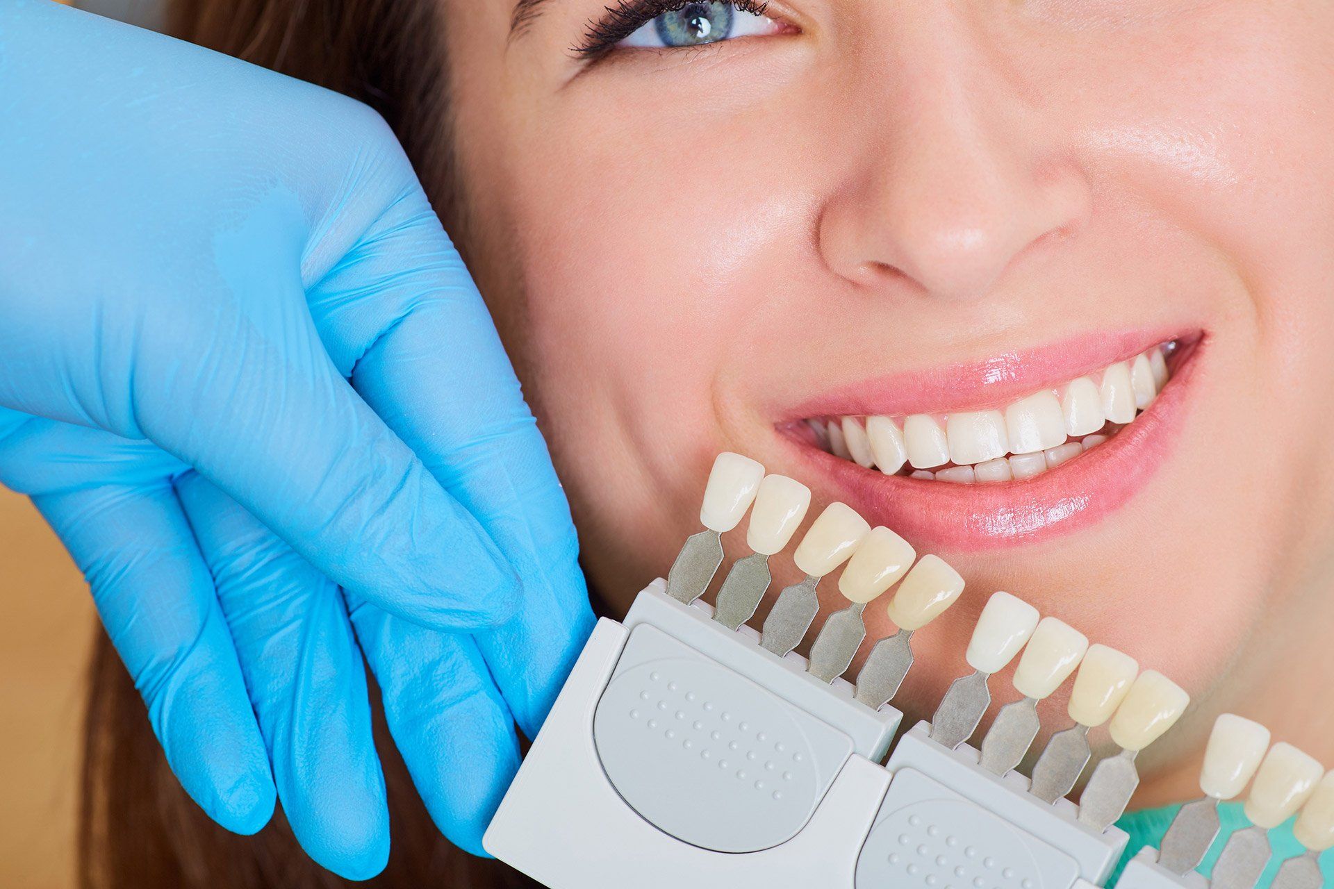 dental crowns - Glenville Smiles -Schenectady, NY