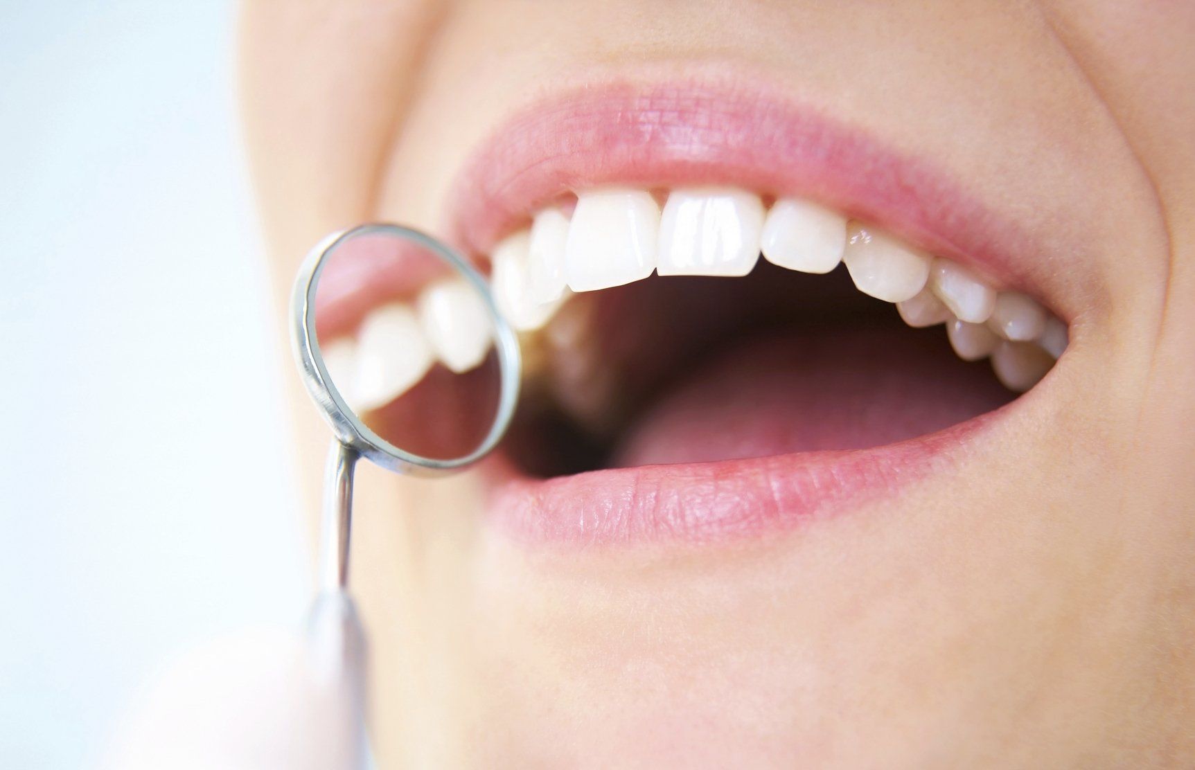 dental bridges - Glenville Smiles -Schenectady, NY