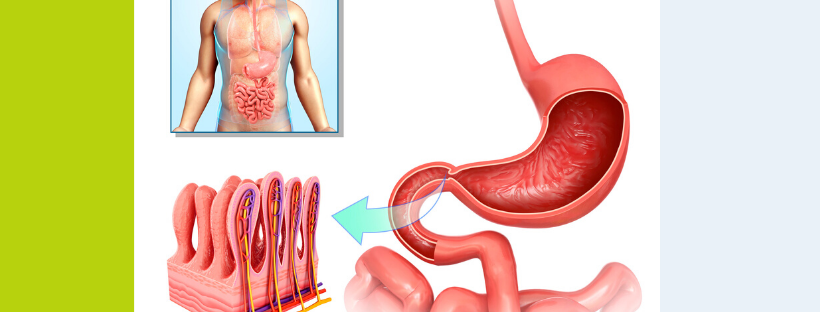 autoimmune, hashimotos, psoriasis, nutrition, leaky gut, microbiome