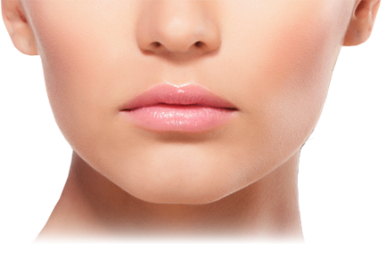 Lip Augmentation with Restylane Lip augmentation - Thousand Oaks | Westlake Village