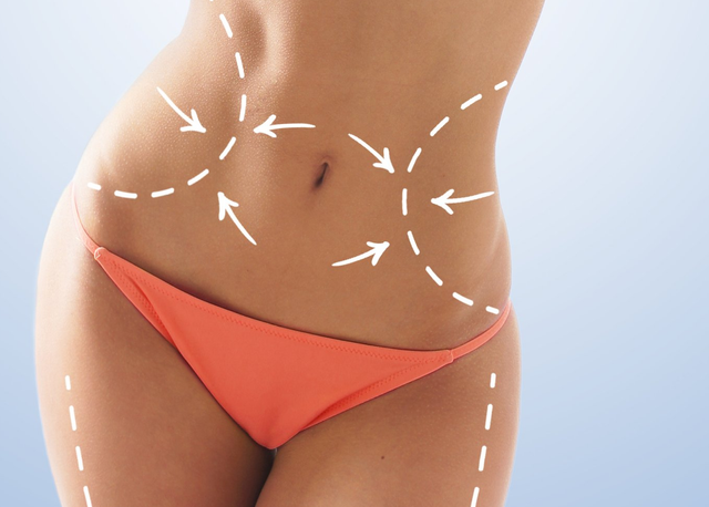 how much do lipo c injections cost Liposuction cost, prices and specials in California bpc 157 for interstitial Variant:20mg BIM
