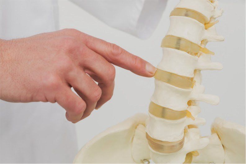 Posture Correction