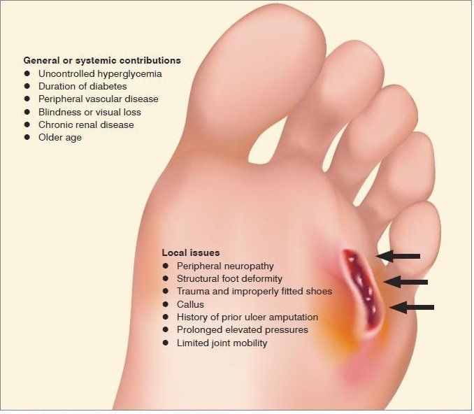 Foot Image