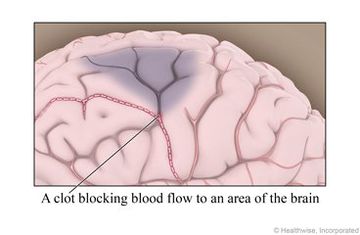 Brain
