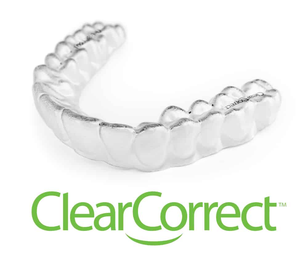 Clear Aligners 