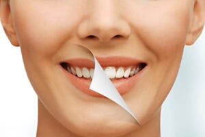 Women Smile Before And After - Dental Cleaning in Schererville, IN Women Smile Before And After - Dental Cleaning in Schererville, IN