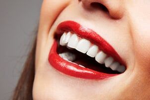 Woman Smiling — cosmetic dentistry in Schererville, IN Woman Smiling — cosmetic dentistry in Schererville, IN