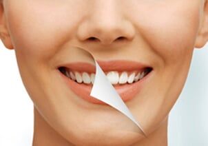 Women Smile Before and After - Dental Cleaning in Schererville, IN Women Smile Before and After - Dental Cleaning in Schererville, IN