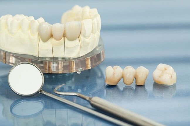 A model of teeth , dental instruments , and dental crowns on a table.