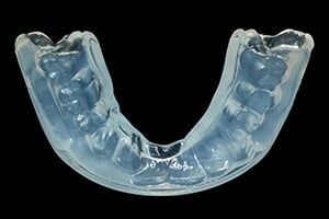 Dental Night Guards - Night Guards in Schererville, IN Dental Night Guards - Night Guards in Schererville, IN