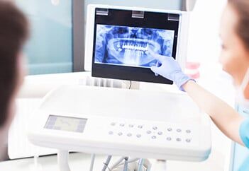 Pan_x_ray — digital x-rays in Schererville, IN Pan_x_ray — digital x-rays in Schererville, IN