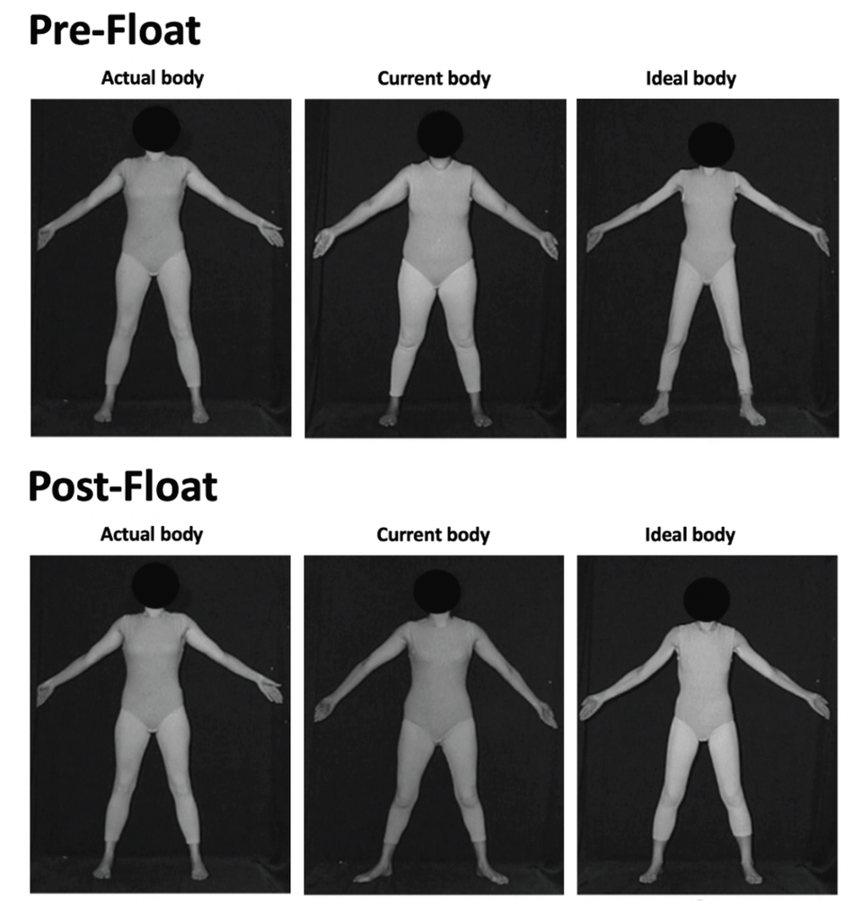 Floating Toward Recovery - Eating Disorders