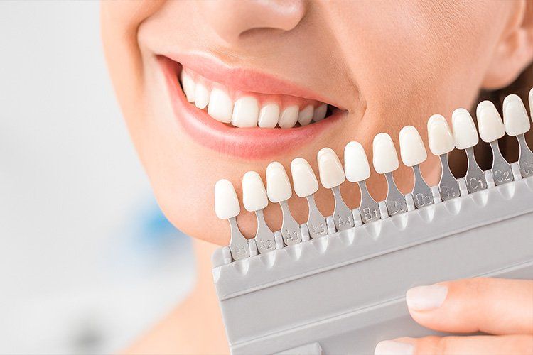 Woman smiling while holding a tooth shade guide with white and dark samples