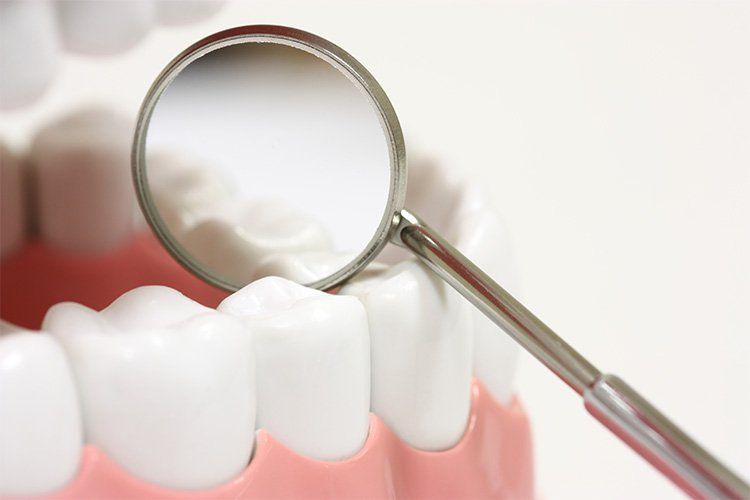 Dental mirror reflecting white teeth and pink gums during a dental exam