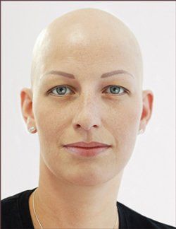 Alopcia Kunden mit Elite Permanent Make-Up von Iris Wolter in Augsburg