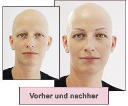 Humanmedizinisches PMU