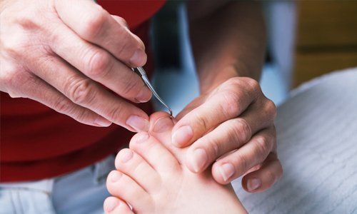 Chiropody