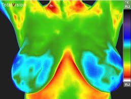 Breast Clear Low Risk — Hudson, NY — Serenity Wellness Medical Spa