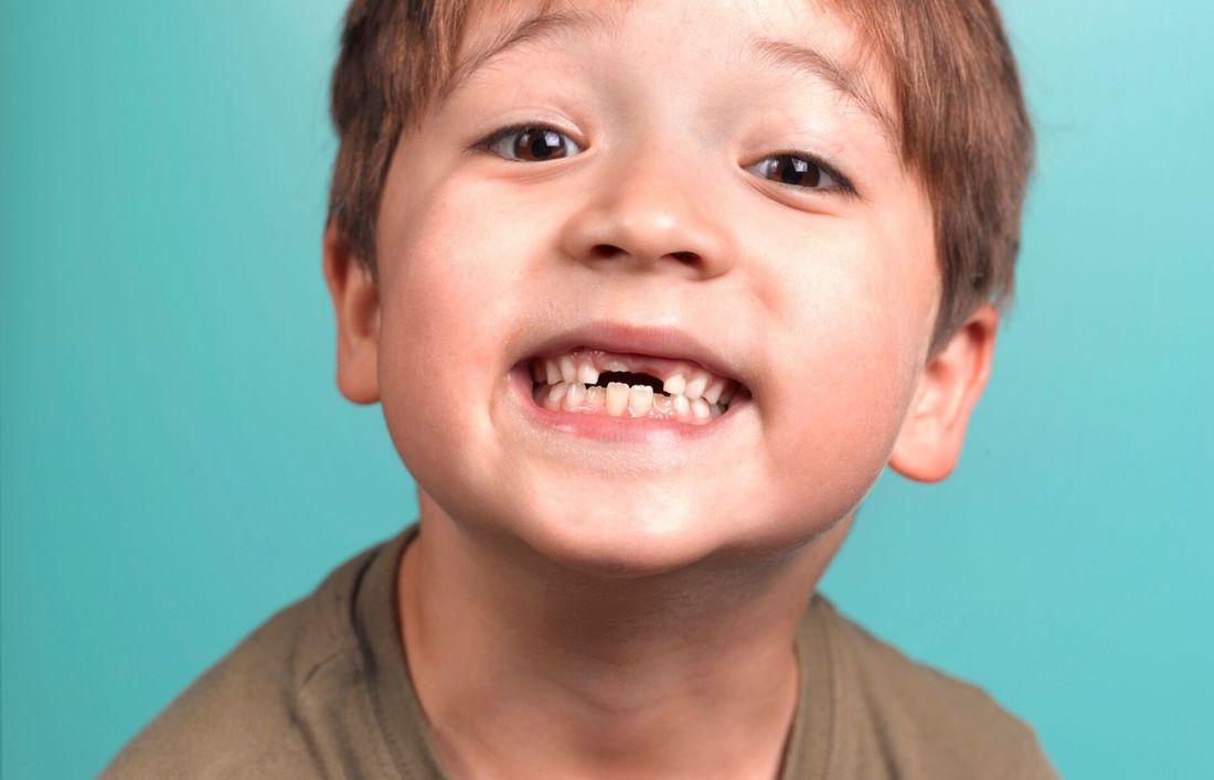pedodonzia