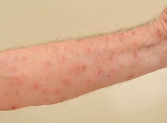 Dermatologia Clinica Sassari