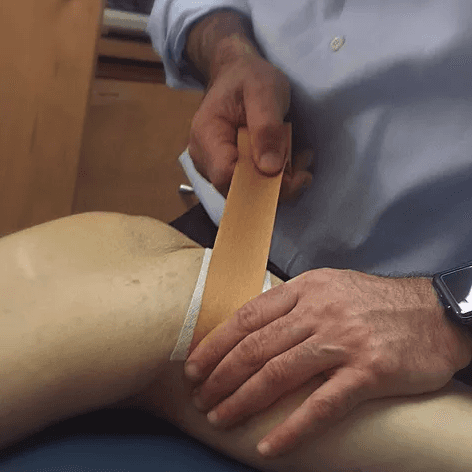 Close-up of a therapist applying therapeutic tape to a patient’s shoulder.