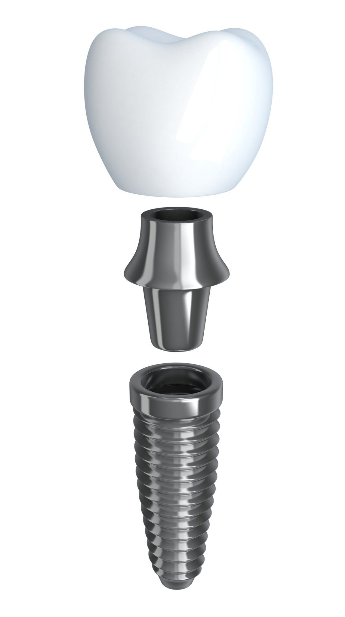 dental implants, dental implants owings mills