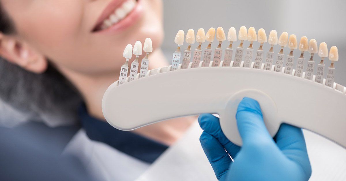 dental veneers, dentist near me