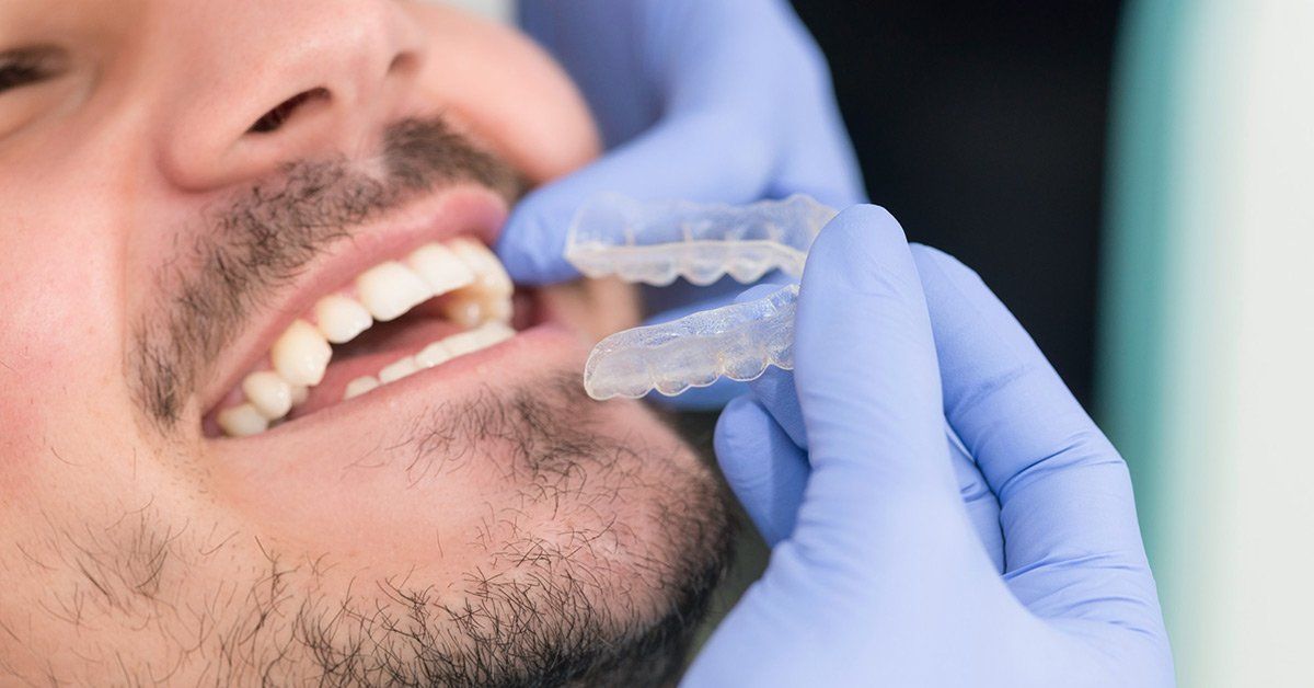 invisalign