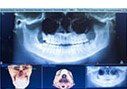 X-Ray Sample — Santa Fe, New Mexico — Dr Theodore D Cho