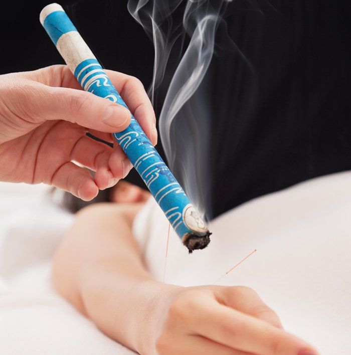 Moxibustion Therapy