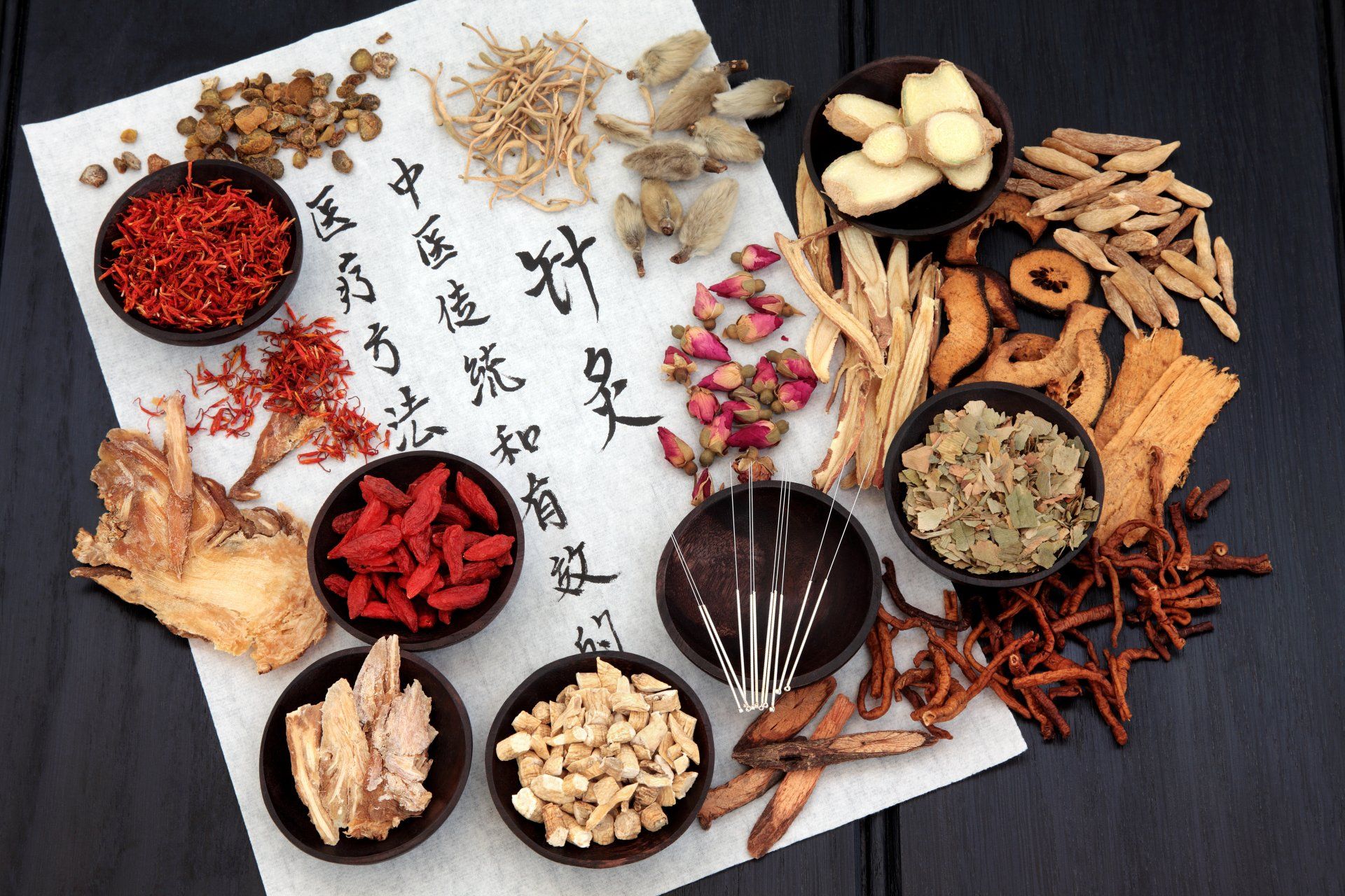 What is Acupuncture?
