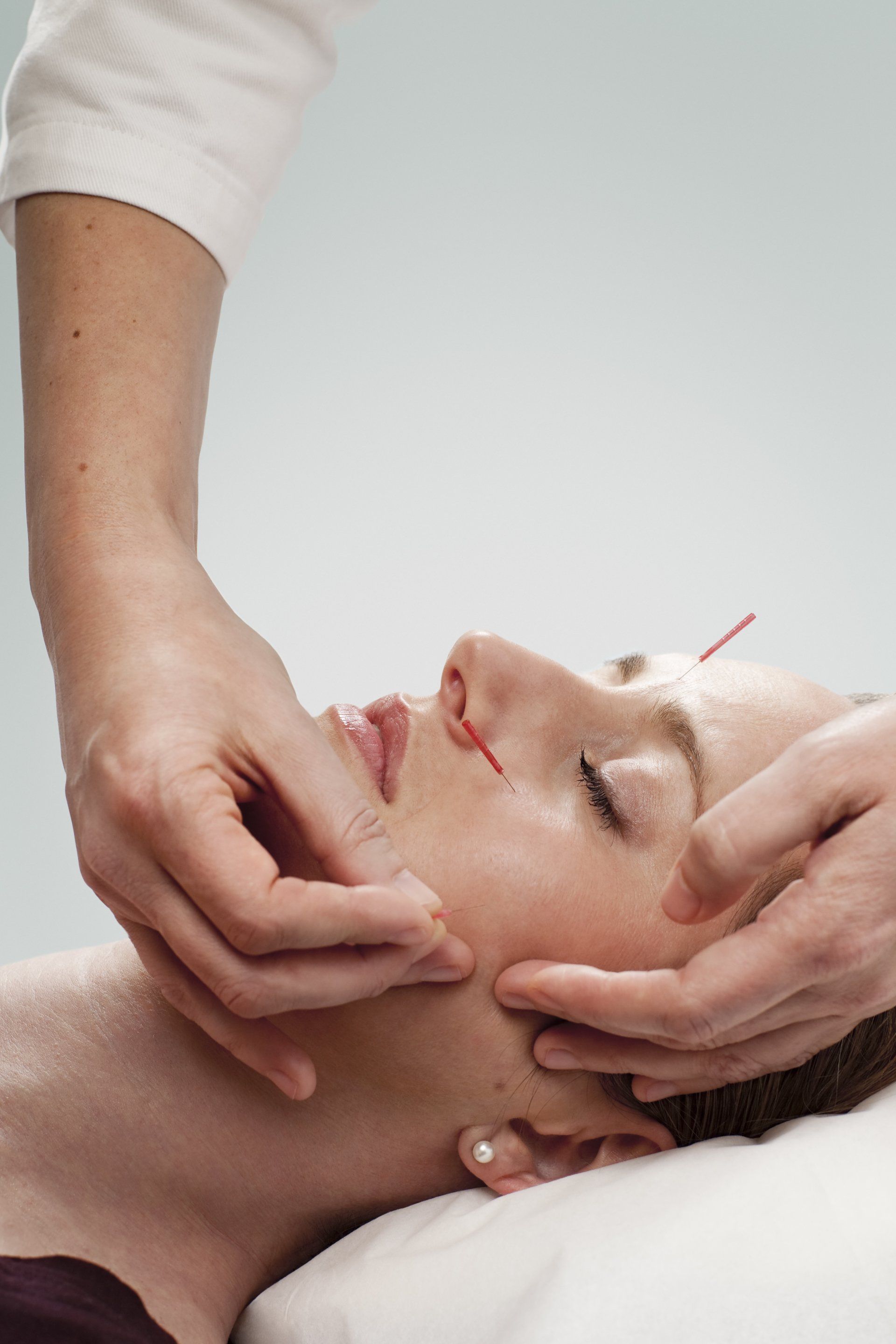 Cosmetic Acupuncture