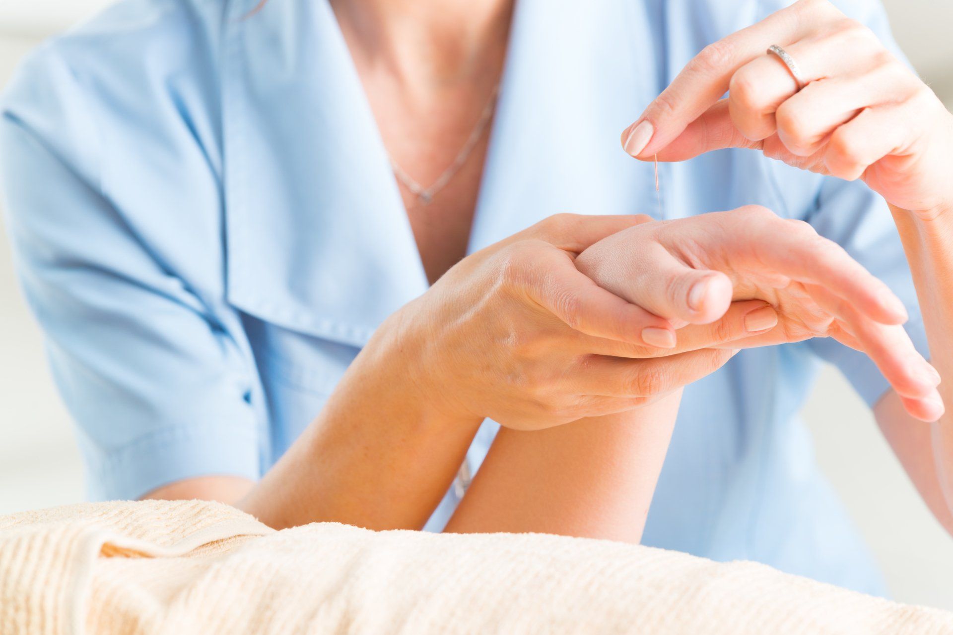 What is Acupuncture?